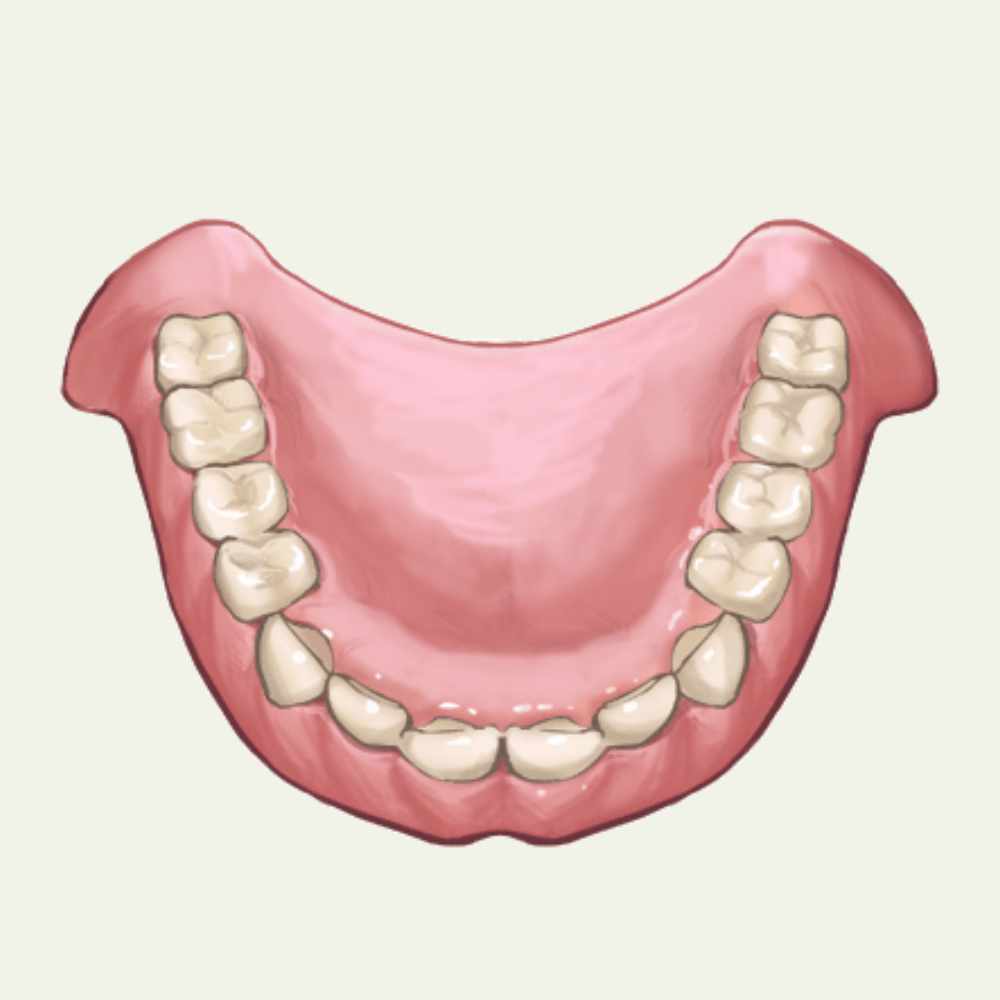 歯茎のトラブル